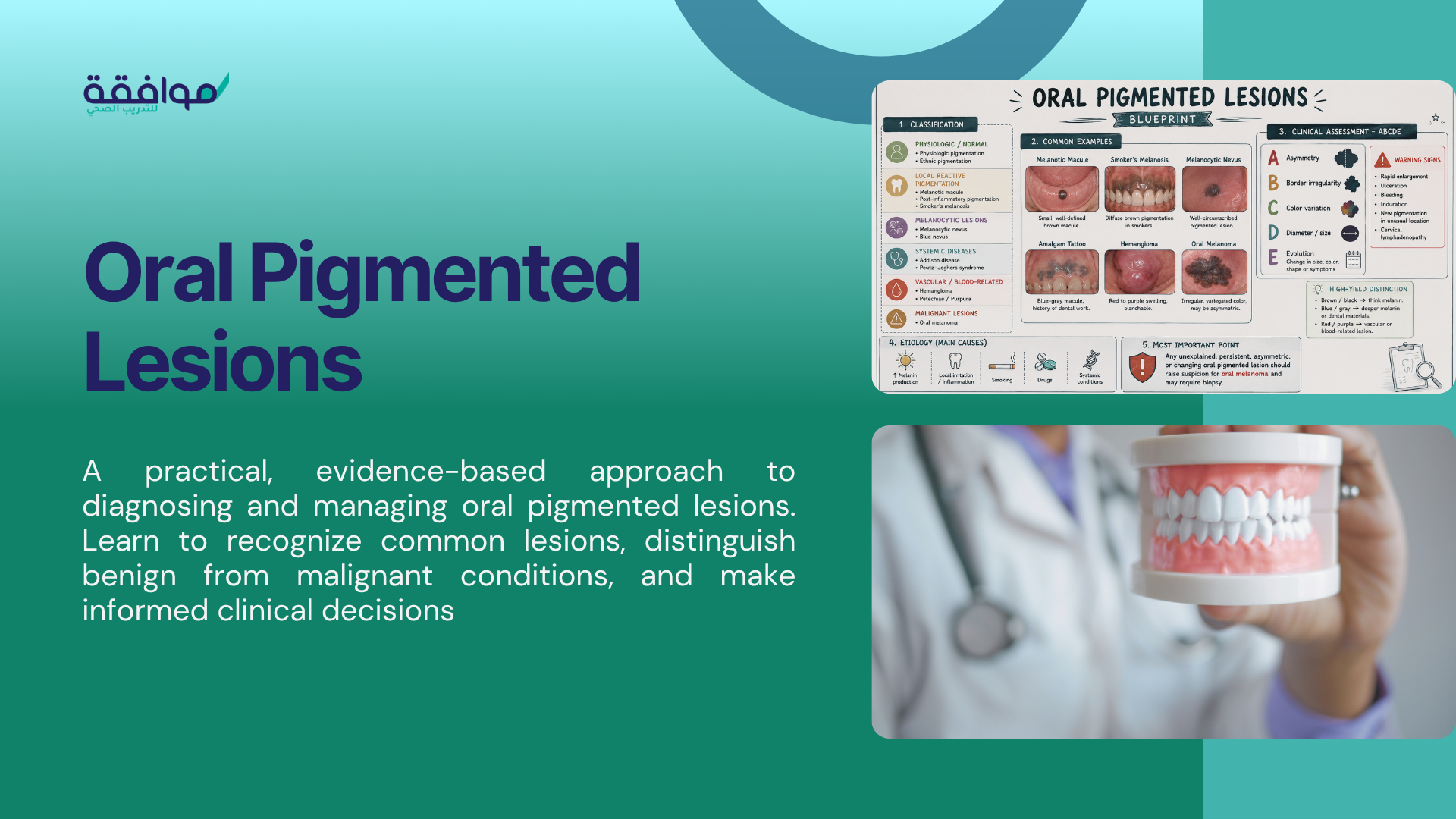 Course Image Oral Pigmented Lesions